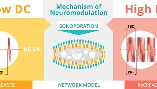 A diagram showing how ultrasound for neuromodulation works