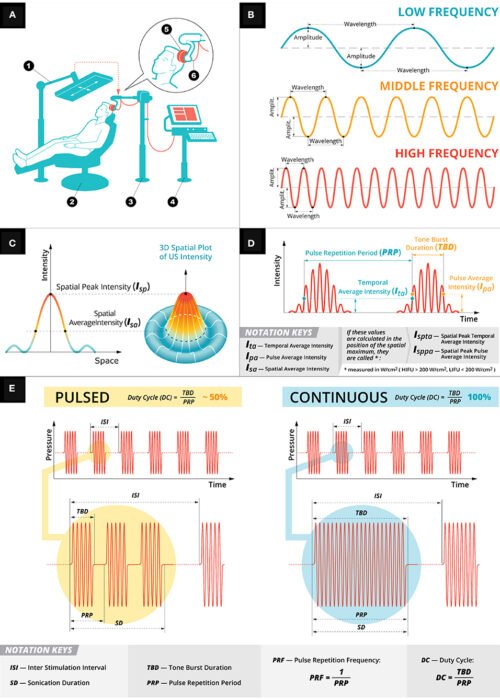 https://devonlinetestserver.com/advanced/wp-content/uploads/2023/03/Current-State-of-Potential-Mechanisms-Supporting-Low-Intensity-Focused-Ultrasound-for-Neuromodulation-Figure-1-500x700.jpg